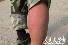 腿累的图片,探寻腿部疲惫背后的秘密